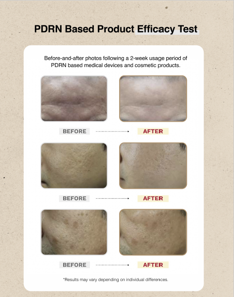 Bellegen PDRN Serum