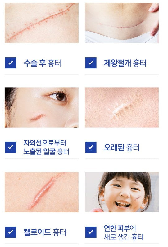 Medifoam Scargel - Scar Care